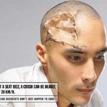 young man with smashed head